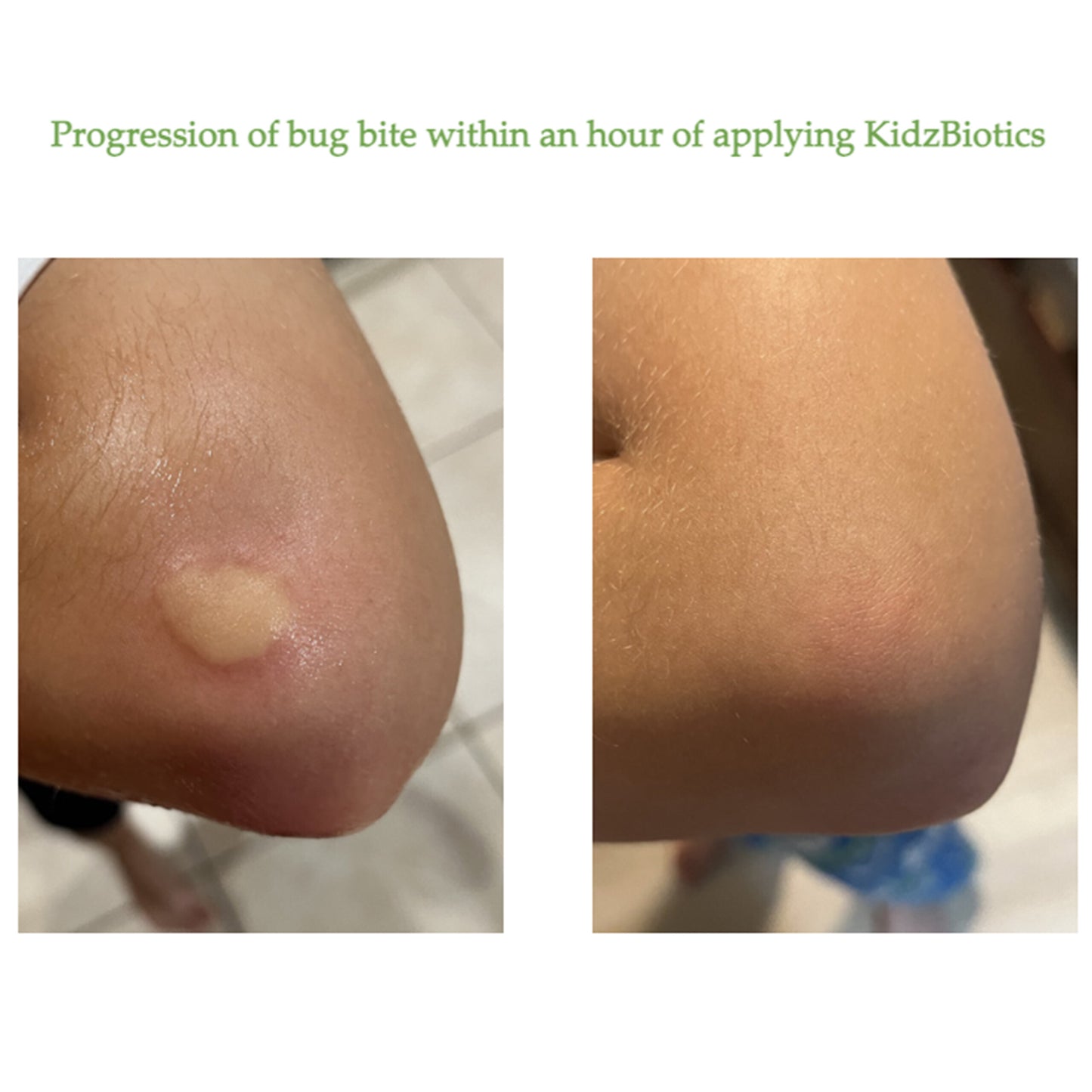 KidzBiotics Natural Probiotic Skin Care Spray for Kids